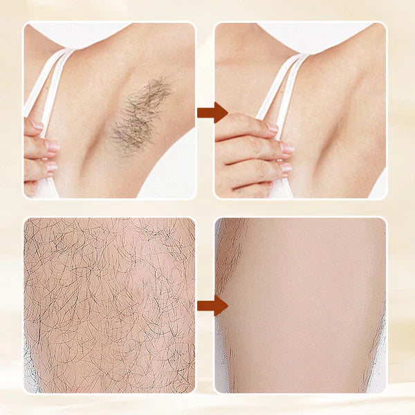 (🔥Kupite 1, dobite 1 gratis🔥)Vsestranska, aromatična krema za odstranjevanje dlak z blago formulo