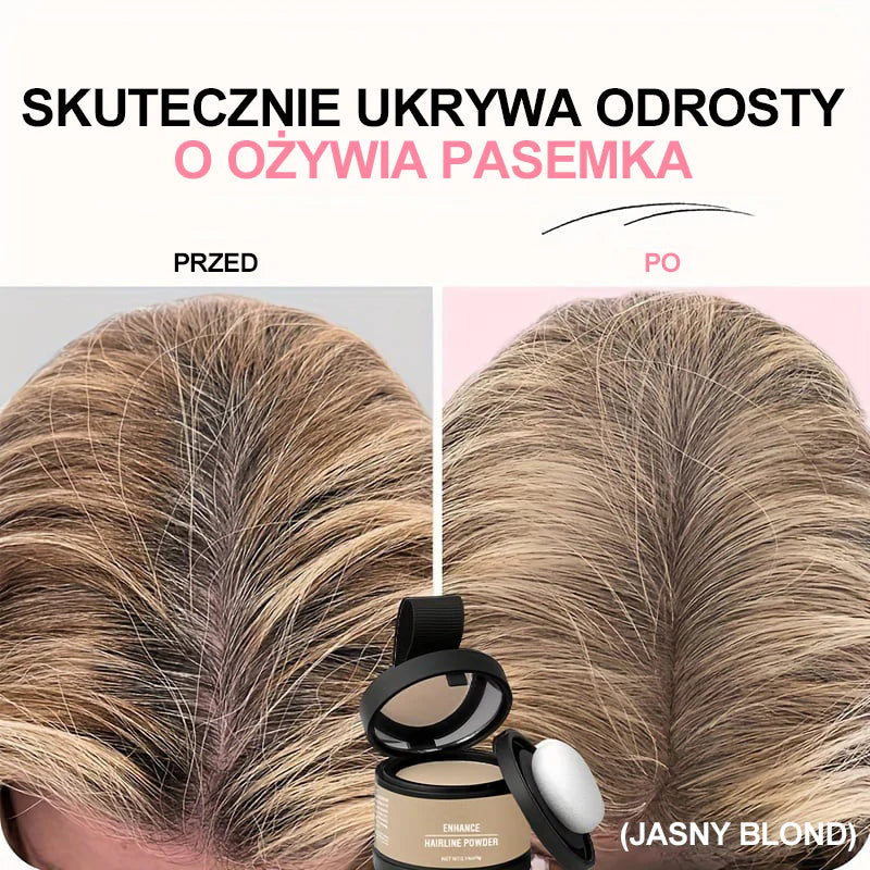 Puder za kosućš„Transplantacija kose za 5 sekundić (za sve boje kose)