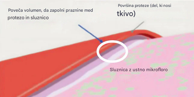 【👍Okrepi zobno protezo】(Prodaja z izgubo!)🔥AdhereDent® Termoplastično lepilo za proteze(Kupite 1, dobite 1 gratis)