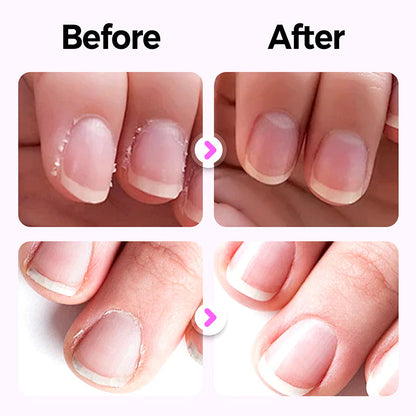 💅 3-in-1 Körömápolási Toll: 1+1 INGYEN! Erősebb Körmök Otthon! ✨