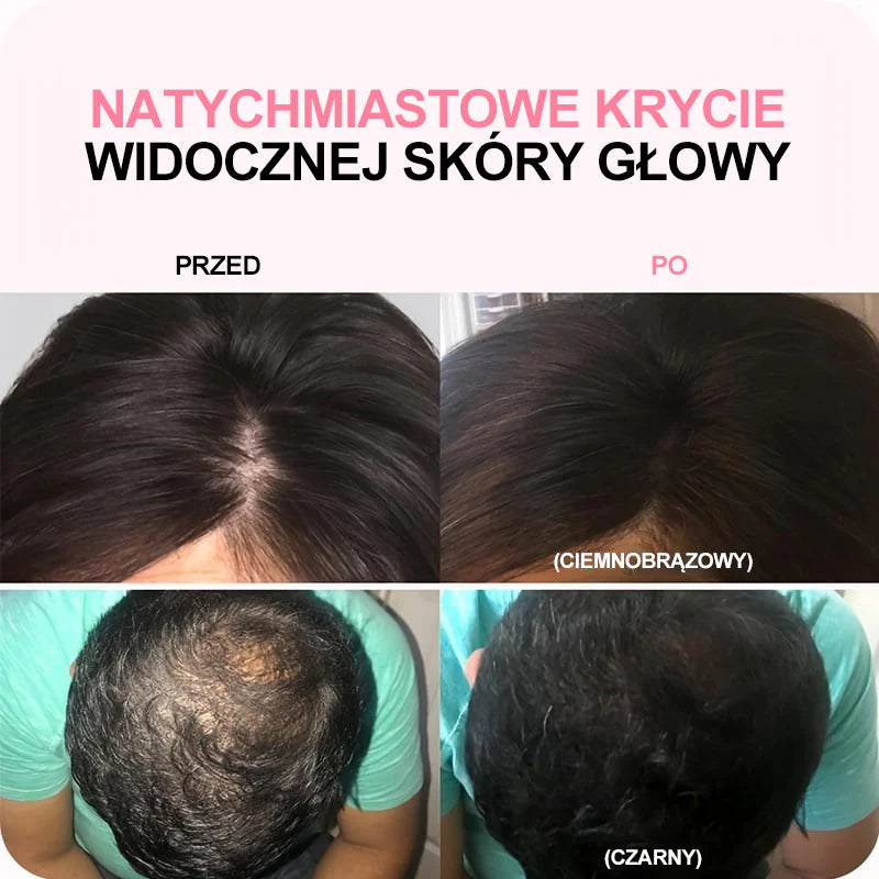 Puder za kosu【🔥Transplantacija kose za 5 sekundi】 (za sve boje kose)