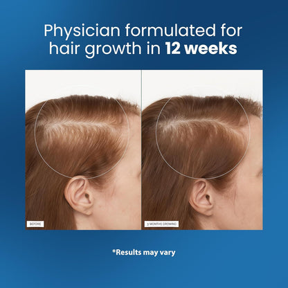 (❗Omogoča vam goste lase🔥) Serum za lase【🔥Kupite 1, dobite 1 gratis】
