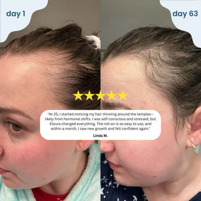 (❗Omogoča vam goste lase🔥) Serum za lase【🔥Kupite 1, dobite 1 gratis】